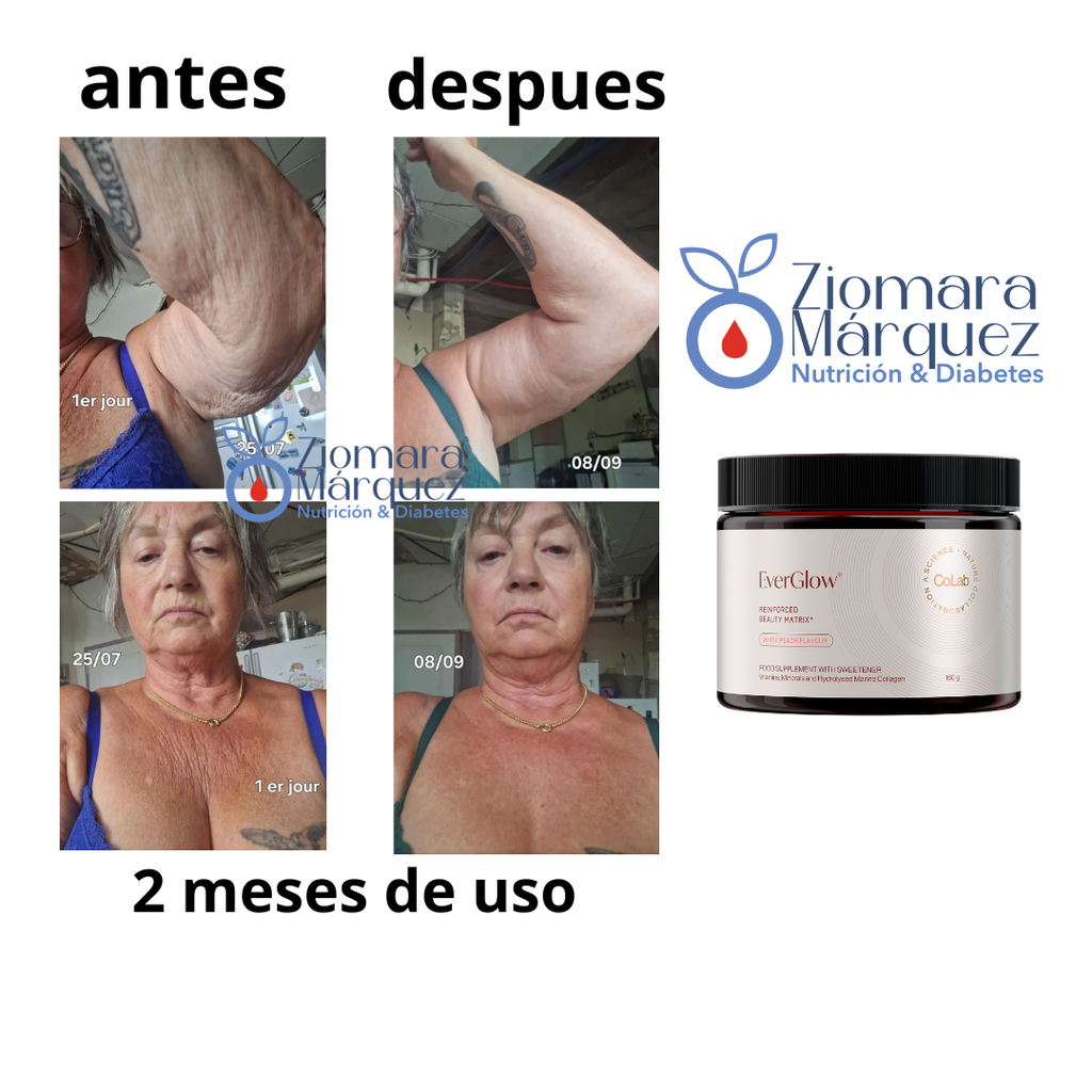 PRODUCTOR DE COLAGENO