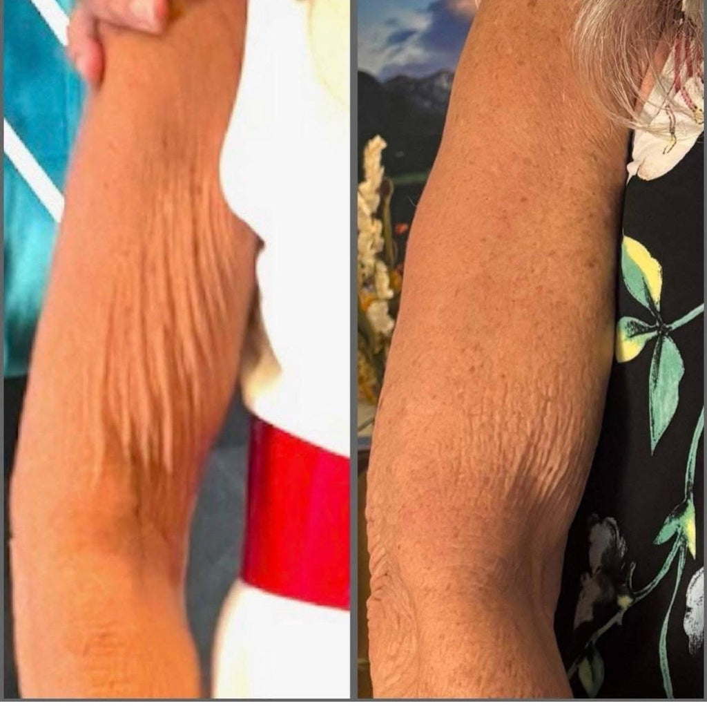 PRODUCTOR DE COLAGENO