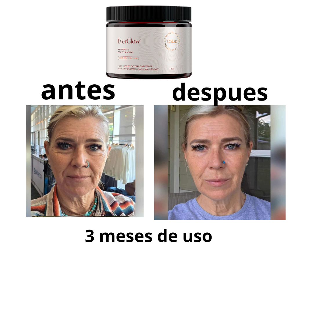 PRODUCTOR DE COLAGENO